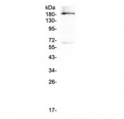 Western blot testing of human U937 cell lysate with Dnmt1 antibody at 0.5ug/ml. Predicted molecular weight 180-200 kDa.