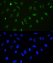IF/ICC staining of FFPE human U-2 OS cells with Dnmt1 antibody (green) at 2ug/ml and DAPI nuclear stain (blue). HIER: steam section in pH6 citrate buffer for 20 min.