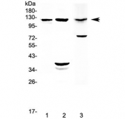 Western blot testing of 1) rat lung, 2) rat pancreas and 3) mouse pancreas with MUC1 antibody at 0.5ug/ml. Expected molecular weight: 120-500 kDa depending on glycosylation level.