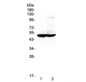 Western blot testing of 1) rat brain and 2) mouse brain tissue lysate with GFAP antibody at 0.5ug/ml. Predicted molecular weight ~50 kDa.