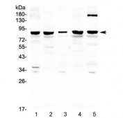 Western blot testing of human 1) HeLa, 2) COLO320, 3) A549, 4) PANC-1 and 5) 22RV1 cell lysate with CARS antibody at 0.5ug/ml. Predicted molecular weight ~85 kDa.