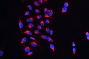 IF/ICC staining of FFPE human U-2 OS cells with CARS antibody (red) at 2ug/ml and DAPI nuclear stain (blue). HIER: steam section in pH6 citrate buffer for 20 min.