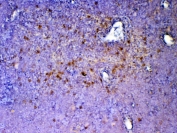 IHC testing of FFPE mouse thymus tissue with ICOS antibody at 1ug/ml. Required HIER: steam section in pH6 citrate buffer for 20 min and allow to cool prior to testing.