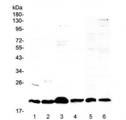 Western blot testing of 1) mouse stomach, 2) mouse spleen, 3) mouse thymus, 4) mouse small intestine, 5) rat thymus and 6) human placental lysate with ICOS antibody at 0.5ug/ml. Predicted molecular weight ~23 kDa.