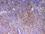 IHC testing of FFPE rat spleen tissue with ICOS antibody at 1ug/ml. Required HIER: steam section in pH6 citrate buffer for 20 min and allow to cool prior to testing.