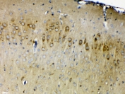 IHC testing of FFPE mouse brain tissue with ERBB4 antibody at 1ug/ml. Required HIER: steam section in pH6 citrate buffer for 20 min and allow to cool prior to testing.