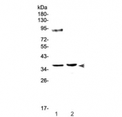 Western blot testing of 1) rat testis and 2) rat ovary tissue lysate with Tbp antibody at 0.5ug/ml. Predicted molecular weight ~38 kDa.