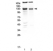 Western blot testing of 1) rat brain and 2) mouse brain tissue lysate with BMPR2 antibody at 0.5ug/ml. Predicted molecular weight ~115 kDa.