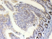 IHC testing of FFPE rat small intestine tissue with ETV6 antibody at 1ug/ml. Required HIER: steam section in pH6 citrate buffer for 20 min and allow to cool prior to testing.