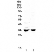 Western blot testing of 1) rat stomach and 2) mouse stomach lysate with ERCC1 antibody at 0.5ug/ml. Predicted molecular weight: 25-36 kDa (multiple isoforms).