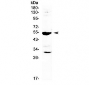 Western blot testing of rat RH35 cell lysate with Mmp13 antibody at 0.5ug/ml. Predicted molecular weight ~54 kDa.