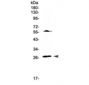 Western blot testing of human Jurkat cell lysate with IL17A antibody at 0.5ug/ml. Expected molecular weight: 15-20 kDa (monomer), 30-40 kDa (homodimer), depending on glycosylation level.