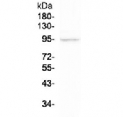 Western blot testing of human A375 cell lysate with FAP antibody at 0.5ug/ml. Predicted molecular weight: 88-95 kDa (monomer), ~27 kDa (truncated form), ~170 kDa (homodimer).