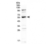 Western blot testing of rat lung tissue with EPO Receptor antibody at 0.5ug/ml. Predicted molecular weight ~55 kDa (memebrane bound form), ~29 kDa (soluble form).