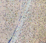 IHC staining of FFPE mouse brain tissue with Sacsin antibody, HRP-labeled secondary and DAB substrate. HIER: boil tissue sections in pH8 EDTA for 20 min and allow to cool before testing.