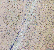 IHC testing of FFPE rat brain tissue with Sacsin antibody at 1ug/ml. Required HIER: steam section in pH6 citrate buffer for 20 min and allow to cool prior to testing.