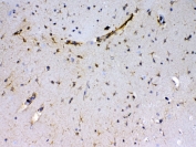 IHC testing of FFPE mouse brain tissue with Sacsin antibody at 1ug/ml. Required HIER: steam section in pH6 citrate buffer for 20 min and allow to cool prior to testing.