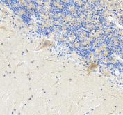 IHC testing of FFPE mouse brain tissue with Sacsin antibody at 1ug/ml. Required HIER: steam section in pH6 citrate buffer for 20 min and allow to cool prior to testing.