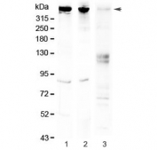 Western blot testing of 1) rat brain, 2) mouse brain and 3) human HeLa lysate with Sacsin antibody at 0.5ug/ml. Predicted molecular weight ~521 kDa.