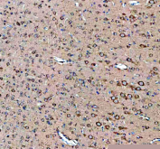 IHC staining of FFPE rat brain tissue with Sacsin antibody, HRP-labeled secondary and DAB substrate. HIER: boil tissue sections in pH8 EDTA for 20 min and allow to cool before testing.
