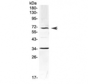 Western blot testing of mouse HEPA1-6 cell lysate with Alpha 1 Fetoprotein antibody at 0.5ug/ml. Predicted molecular weight ~69 kDa.