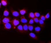 Immunofluorescent staining of FFPE human A549 cells with VEGFR1 antibody (red) and DAPI nuclear stain (blue). HIER: steam section in pH6 citrate buffer for 20 min.