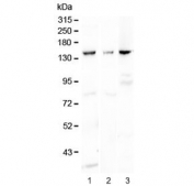 Western blot testing of 1) rat kidney, 2) mouse liver and 3) mouse HEPA1-6 lysaste with VEGF Receptor 1 antibody at 0.5ug/ml. Predicted molecular weight ~150 kDa.