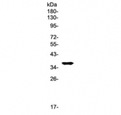 Western blot testing of rat liver lysate with GALE antibody at 0.5ug/ml. Predicted molecular weight ~38 kDa.