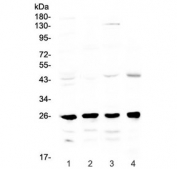 Western blot testing of 1) rat brain, 2) rat lung, 3) mouse stomach and 4) mouse kidney lysate with GSTM1 antibody at 0.5ug/ml. Predicted molecular weight ~26 kDa.