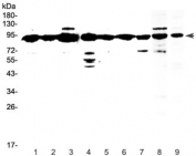 Western blot testing of human 1) HeLa, 2) placenta, 3) MCF7, 4) HepG2, 5) A549, 6) SKOV3, 7) PANC-1 and 8) mouse testis and 9) rat testis lysate with XRCC1 antibody at 0.5ug/ml. Rountinely observed molecular weight: 69~90 kDa.