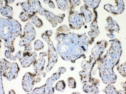 IHC testing of FFPE human placental tissue with XRCC1 antibody at 1ug/ml. Required HIER: steam section in pH6 citrate buffer for 20 min and allow to cool prior to testing.