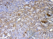 IHC testing of FFPE rat kidney tissue with XRCC1 antibody at 1ug/ml. Required HIER: steam section in pH6 citrate buffer for 20 min and allow to cool prior to testing.