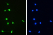 IF/ICC co-staining of FFPE mouse NIH3T3 cells with XRCC1 antibody (green) at 2ug/ml and DAPI nuclear stain (blue). HIER: steam section in pH6 citrate buffer for 20 min.