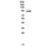 Western blot testing of rat thymus lysate with Ptpn22 antibody at 0.5ug/ml. Expected molecular weight ~92 kDa, but can be observed at up to ~105 kDa.