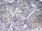 IHC testing of FFPE mouse spleen tissue with Ptpn22 antibody at 1ug/ml. Required HIER: steam section in pH6 citrate buffer for 20 min and allow to cool prior to testing.