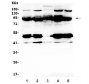 Western blot testing of human 1) SW579, 2) HepG2, 3) placenta, 4) HeLa and 5) SW620 lysate with Ptpn22 antibody at 0.5ug/ml. Expected molecular weight ~92 kDa, but can be observed at up to ~105 kDa.