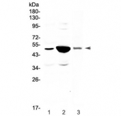 Western blot testing of 1) rat small intestine, 2) rat kidney and 3) mouse kidney lysate with Pai-1 antibody at 0.5ug/ml. Predicted molecular weight ~45 kDa.