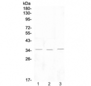 Western blot testing of 1) rat lymph, 2) rat spleen and 3) mouse thymus tissue lysate with NKG2D antibody at 0.5ug/ml. Predicted molecular weight ~25 kDa (unmodified), ~35 kDa (glycosylated).