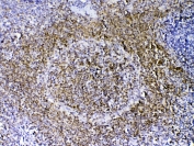 IHC testing of FFPE rat spleen tissue with PAX5 antibody at 1ug/ml. Required HIER: steam section in pH6 citrate buffer for 20 min and allow to cool prior to testing.