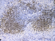 IHC testing of FFPE mouse spleen tissue with PAX5 antibody at 1ug/ml. Required HIER: steam section in pH6 citrate buffer for 20 min and allow to cool prior to testing.