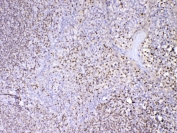IHC testing of FFPE human tonsil tissue with PAX5 antibody at 1ug/ml. Required HIER: steam section in pH6 citrate buffer for 20 min and allow to cool prior to testing.