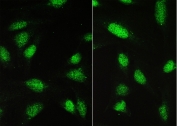 IF/ICC staining of FFPE human U-2 OS cells with PAX5 antibody (green) at 2ug/ml. HIER: steam section in pH6 citrate buffer for 20 min.