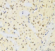 IHC staining of FFPE mouse brain tissue with SOX10 antibody. HIER: boil tissue sections in pH8 EDTA for 20 min and allow to cool before testing.
