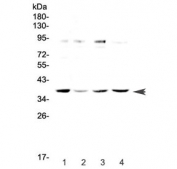 Western blot testing of rat 1) spleen, 2) thymus, 3) liver and 4) testis lysate with OGG1 antibody at 0.5ug/ml. Predicted molecular weight ~39 kDa.
