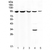 Western blot testing of 1) human 293T, 2) human HepG2, 3) human A549, 4) rat liver and 5) mouse small intestine lysate with Complement C7 antibody at 0.5ug/ml. Predicted molecular weight ~93 kDa.