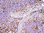 IHC testing of FFPE mouse spleen tissue with ADA antibody at 1ug/ml. Required HIER: steam section in pH6 citrate buffer for 20 min and allow to cool prior to testing.