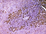 IHC testing of FFPE rat spleen tissue with Ada antibody at 1ug/ml. Required HIER: steam section in pH6 citrate buffer for 20 min and allow to cool prior to testing.
