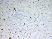 IHC testing of FFPE rat brain tissue with Ada antibody at 1ug/ml. Required HIER: steam section in pH6 citrate buffer for 20 min and allow to cool prior to testing.
