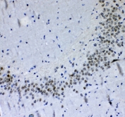 IHC testing of FFPE rat brain tissue with PER1 antibody at 1ug/ml. Required HIER: steam section in pH6 citrate buffer for 20 min and allow to cool prior to testing.