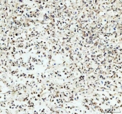 IHC testing of FFPE rat brain tissue with PER1 antibody at 1ug/ml. Required HIER: steam section in pH6 citrate buffer for 20 min and allow to cool prior to testing.